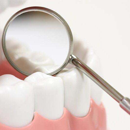 dental check-up render of dental check-up with mirror
