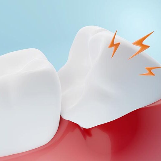 wisdom teeth render of sore wisdom tooth